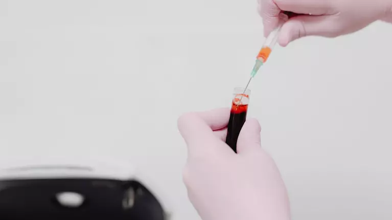 Cum te ajută Synevo să înțelegi mai bine semnalele transmise de organism