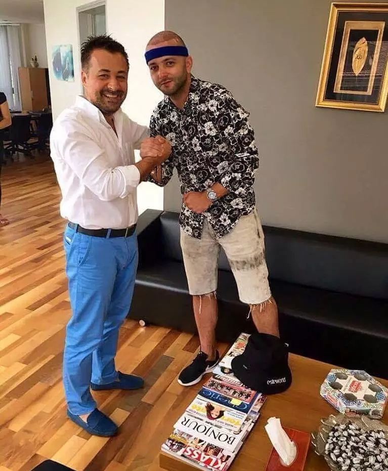 Mihai Morar implant păr