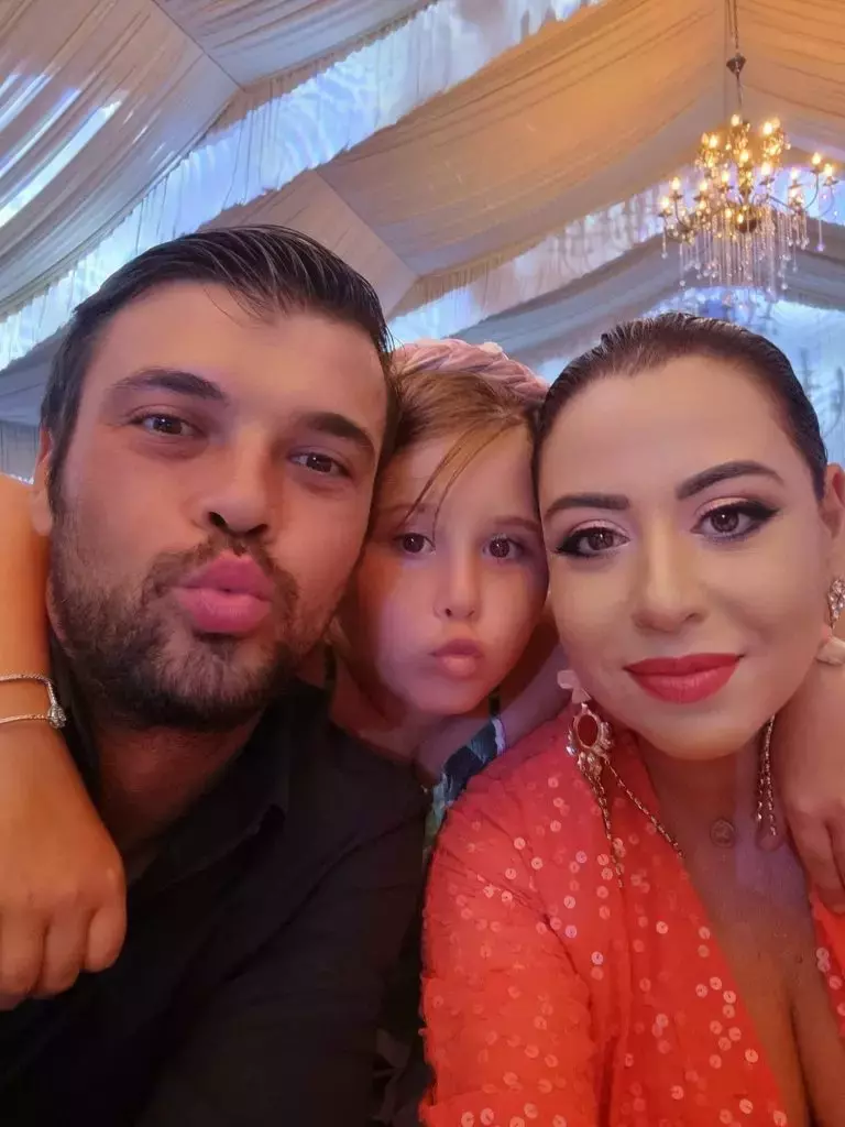 marius-elisei-alopecie-9-768x1024-1