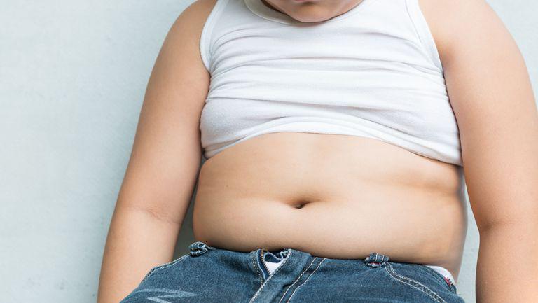 Obezitatea La Copii Revista Baby Pentru Părinti și Copii