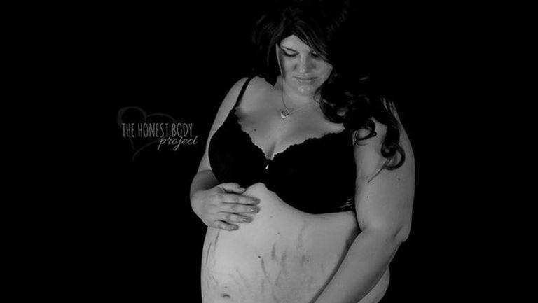 O tânără supraponderală a postat imagini cu ea însărcinată. Reacțiile prietenilor și familiei au șocat-o
