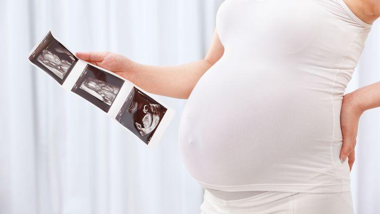 Ecografia de sarcina care a devenit virala