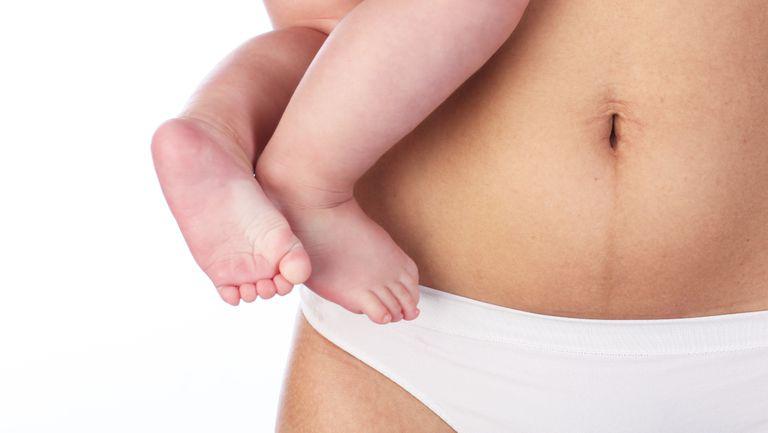 Cum să pierdeți greutatea după cezariană și să eliminați recuperarea abdomenului după naștere