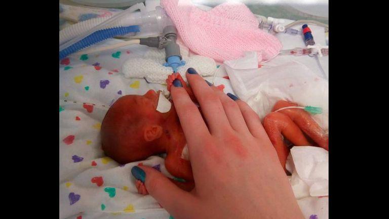 Fetita nascuta cu o zi inainte de data limita pana la care se pot face avorturi