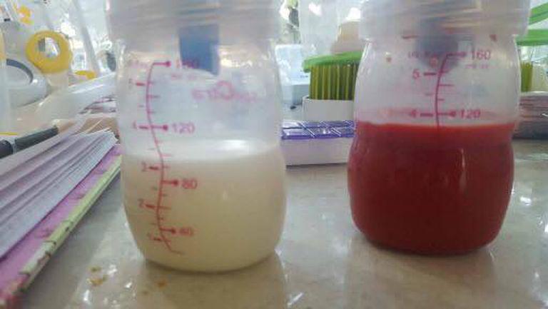 Imaginea postata de o mama dupa ce a pompat laptele Dintr-un san lapte alb, din alt san lapte rosu