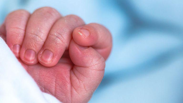Accesul nou născuților prematur la tratament a scăzut dramatic din cauza pandemiei