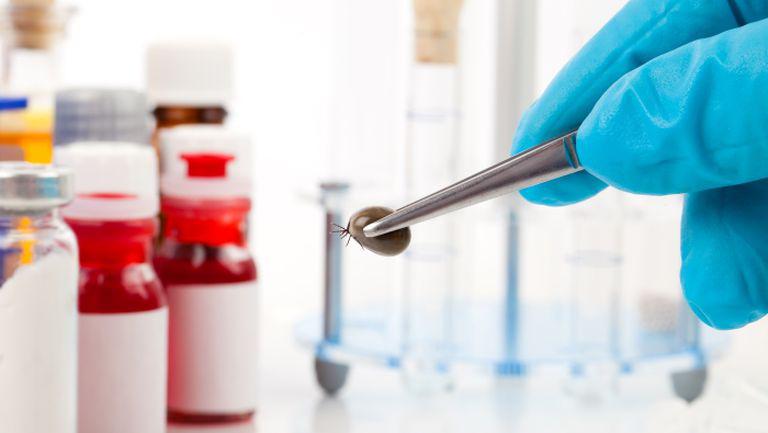 Davvero? 17+  Verità che devi conoscere  Boala Lyme Capusa La Om? Capusa trebuie sa fie prezenta la locul de inoculare pentru o perioada de minimum 24 de ore si trebuie sa fie contaminata cu b.