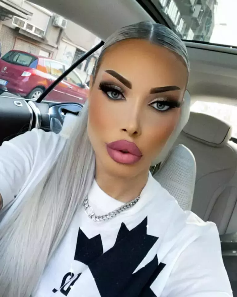 Loredana-Chivu-operatie-liposuctie-1