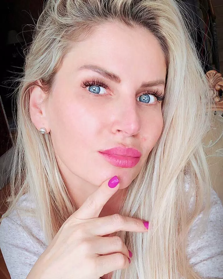 motivul pentru care Andreea Bănică a renunțat la alunița de pe față (2)