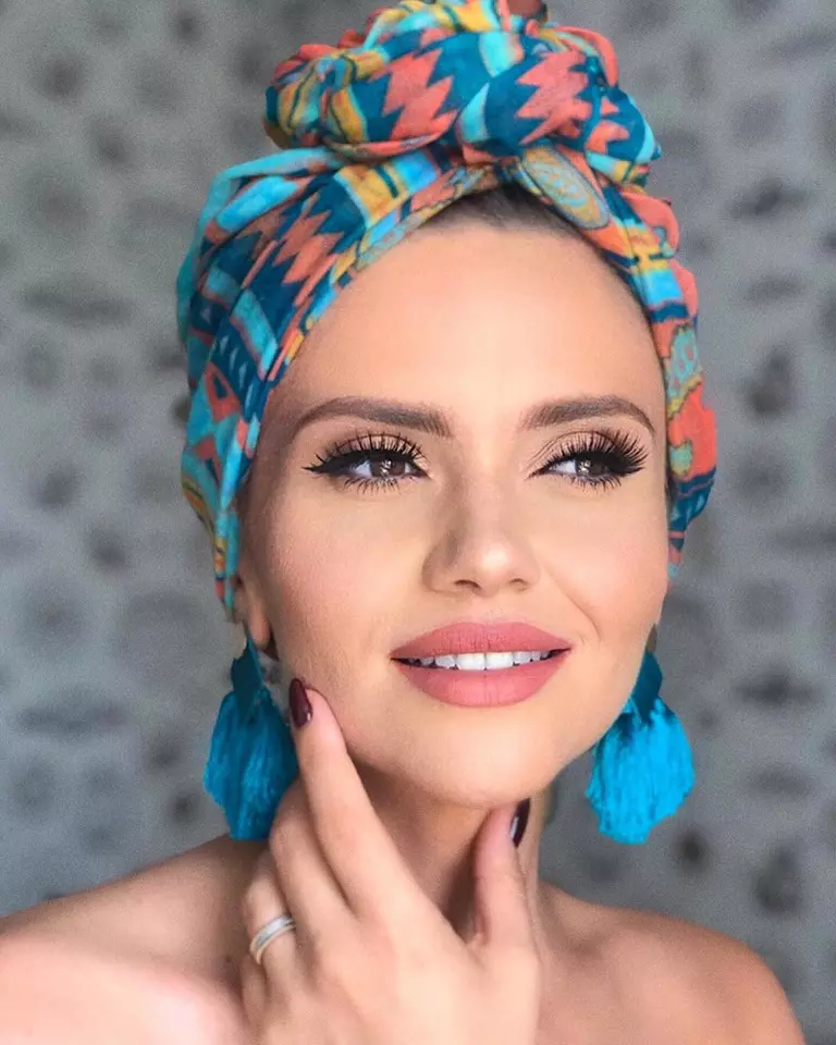Cristina Șișcanu operații estetice (3)