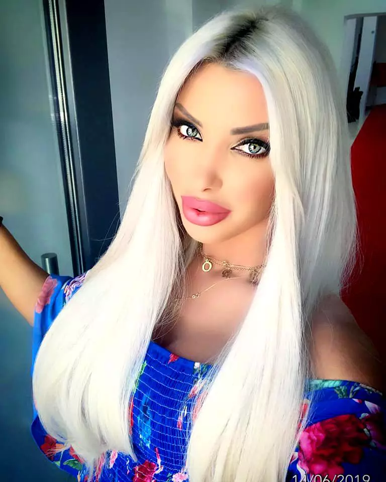 Loredana-Chivu-operatie-liposuctie-5