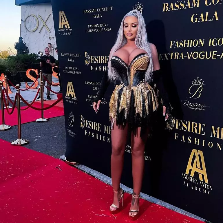 Loredana-Chivu-operatie-liposuctie-3