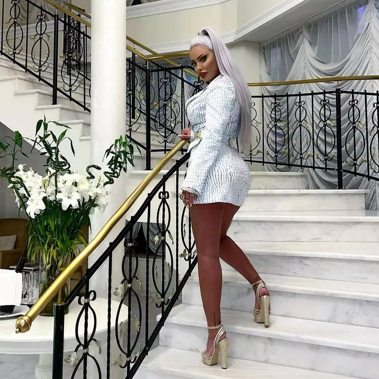 Loredana-Chivu-operatie-liposuctie-4