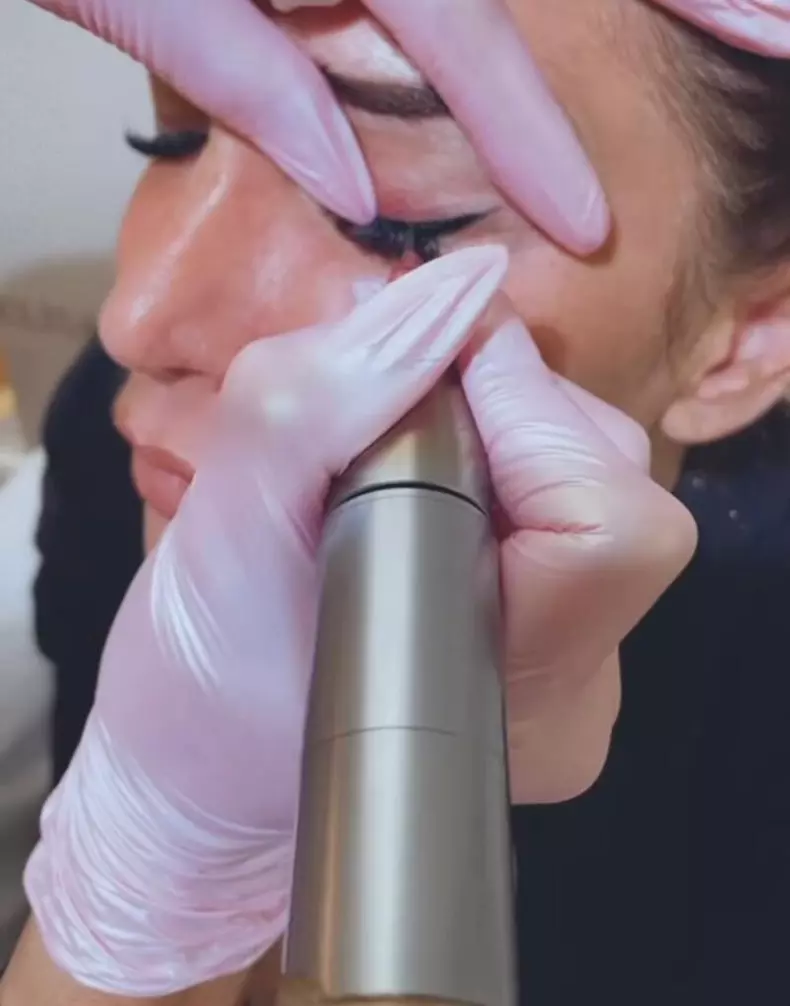 mara-banica-interventie-tatuaj-permanent_88996100