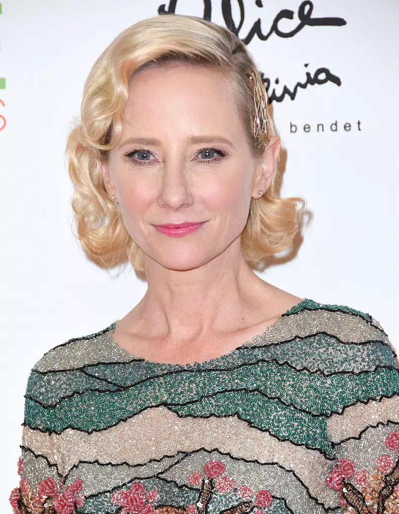 Anne Heche Suffered Severe Brian Injury, Not Expected to Survive