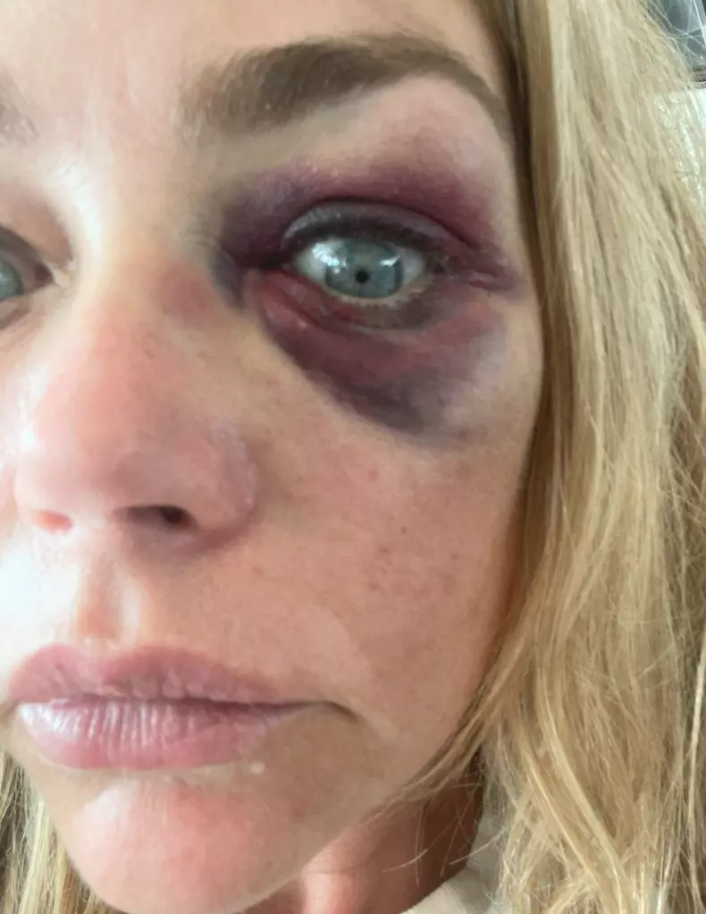 Denise Richards demands Aaron Phypers stop distributing nude pics of her in latest court doc