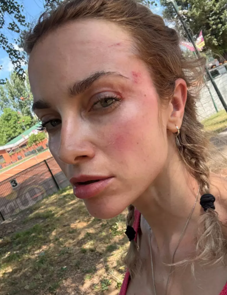 femeie-batuta-parc-1