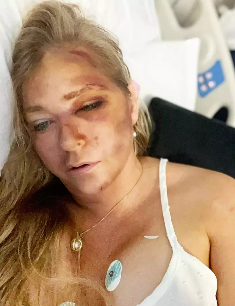 Virginia Giuffre susține că mai are patru zile de trăit după un accident rutier grav