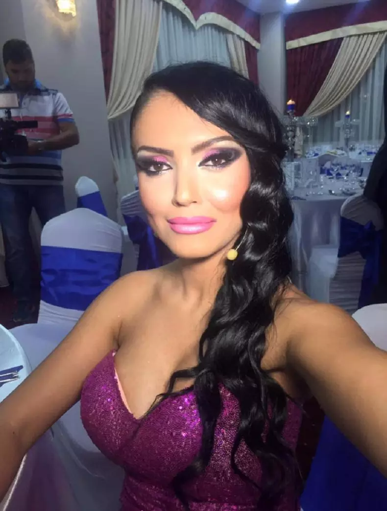 Andreea Mantea are probleme mari cu acneea, pe care o ascunde cu machiaj