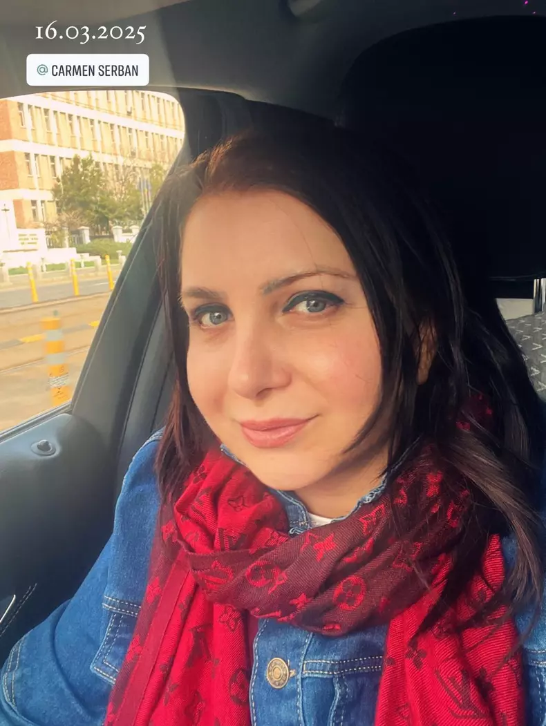 Carmen Șerban - operații estetice (2)