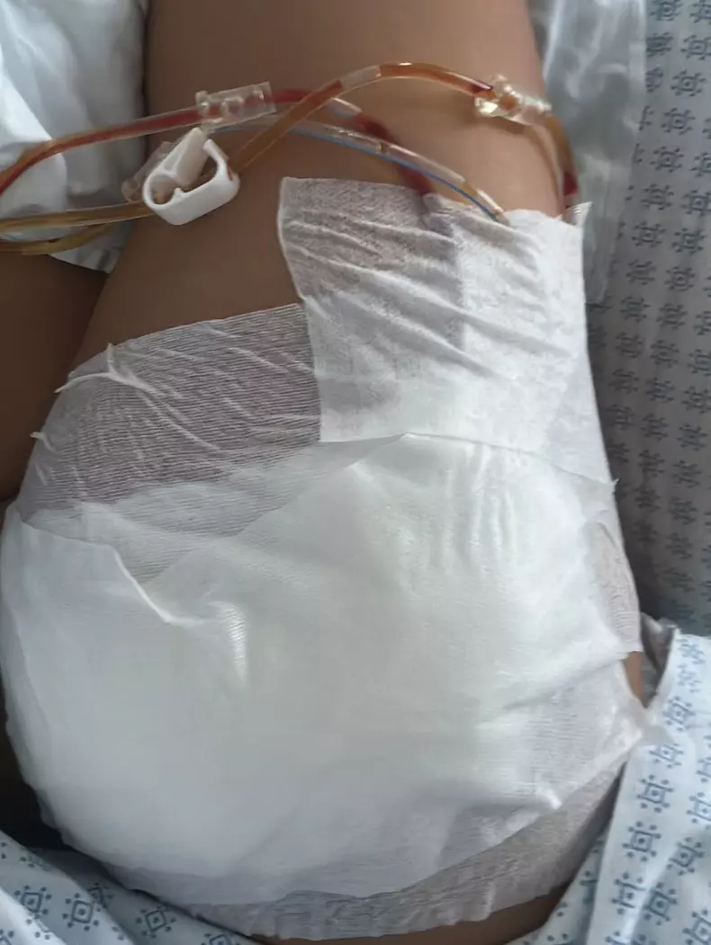 Antonia a ajuns la spital din cauza unei operații estetice (3)