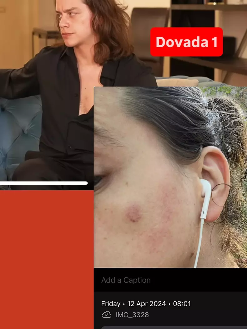Iustin Petrescu susține că a primit un pumn în față de la Marilu Dobrescu