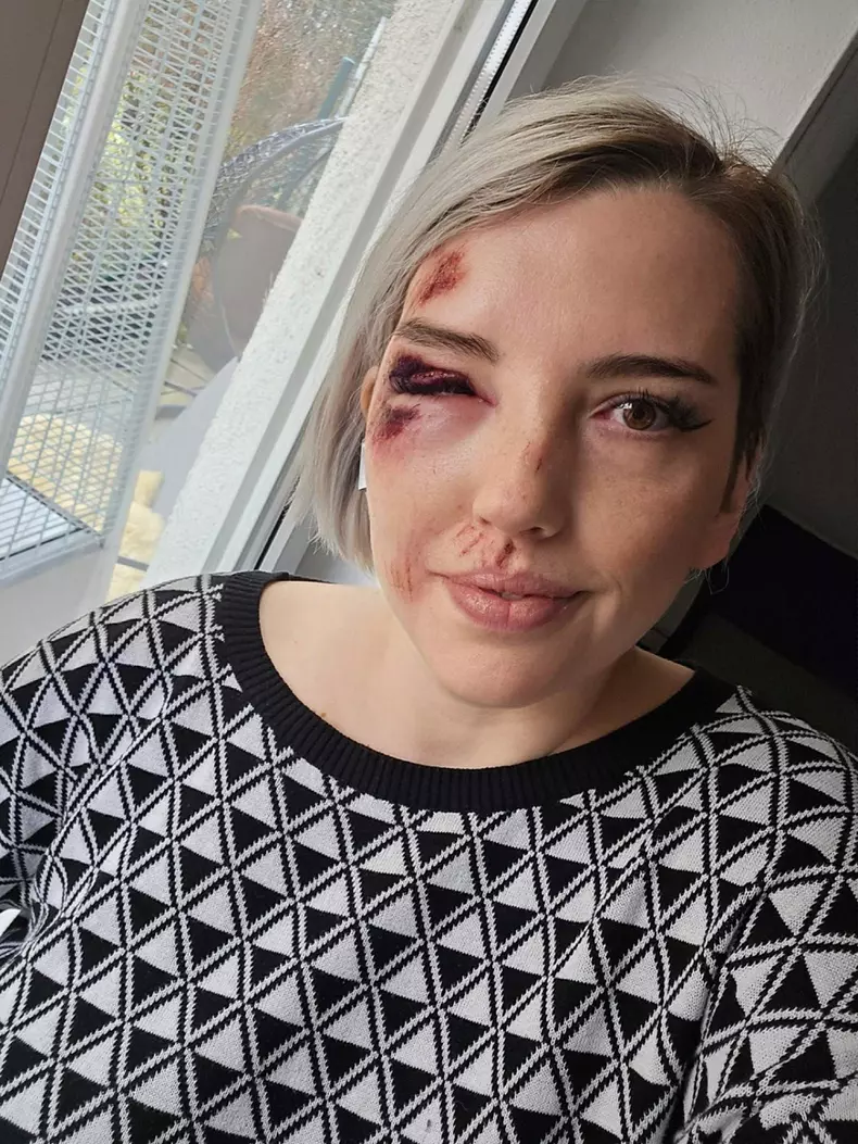 Influencerița Iulia Cristina a apărut cu fața desfigurată pe Instagram (3)