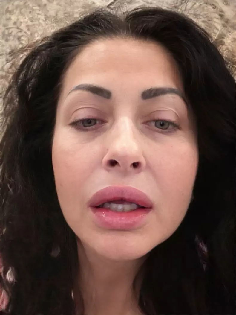gabriela cristea buze umflate