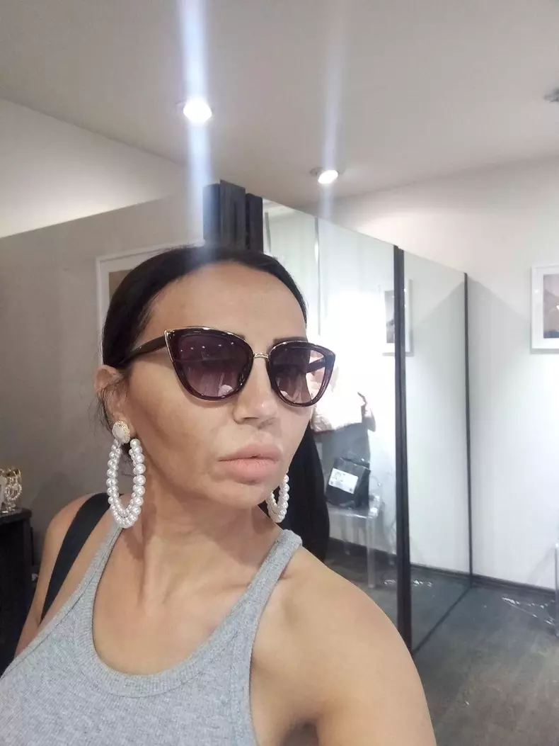 Narcisa Guta şi-a făcut peste 20 de operaţii estetice