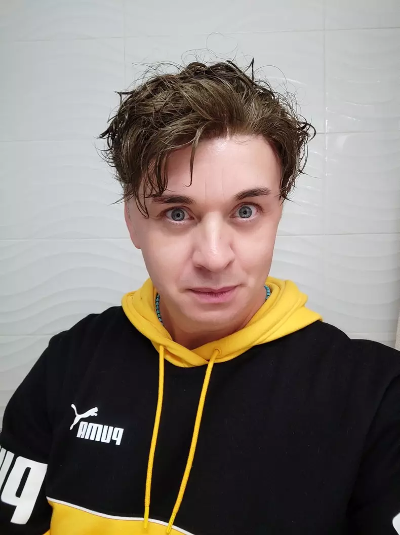 cristi din banat proteza capilara