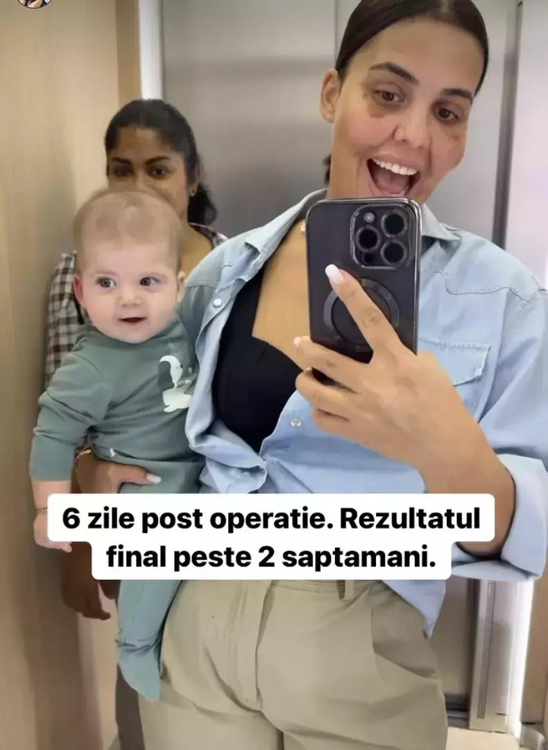 andreea-popescu-operatie-1