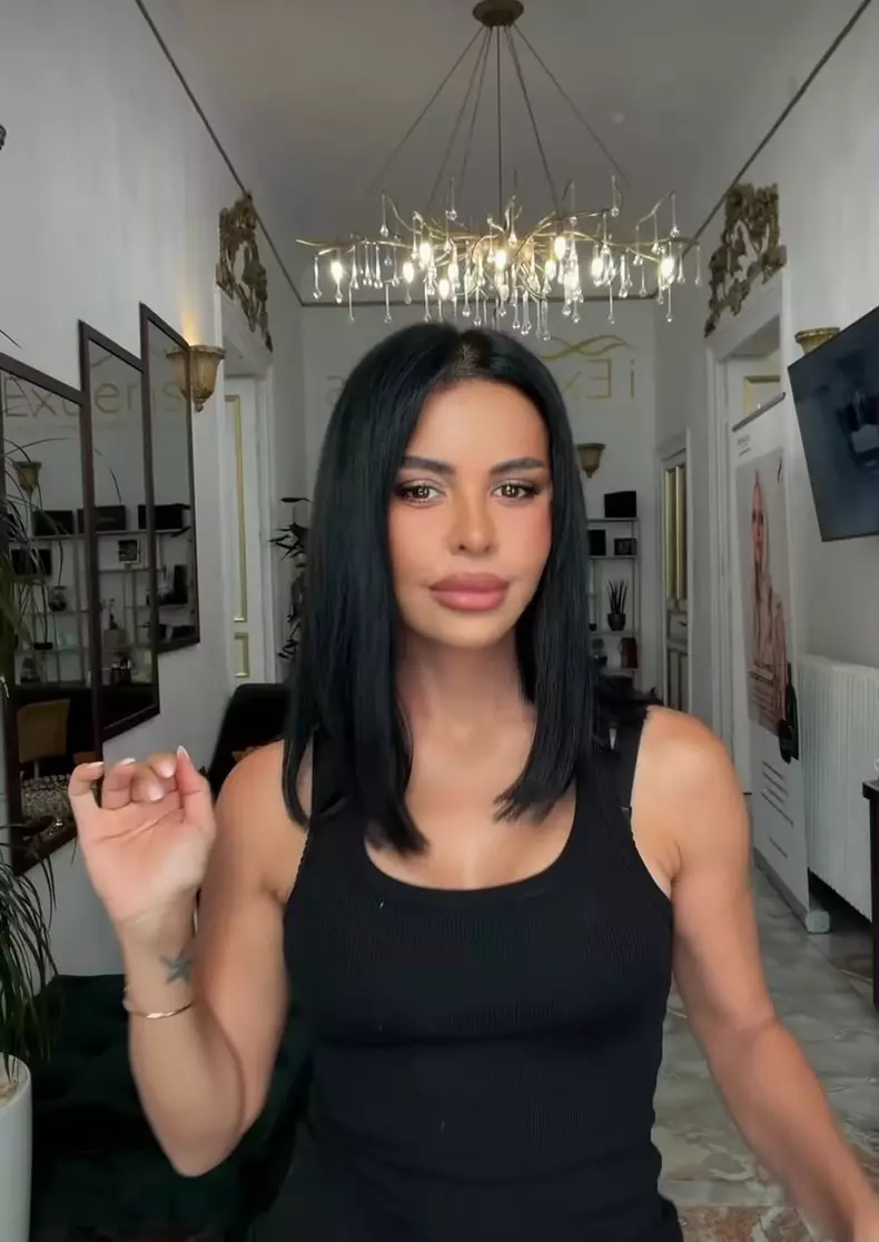 Andreea Popescu dupa operatiile estetice5