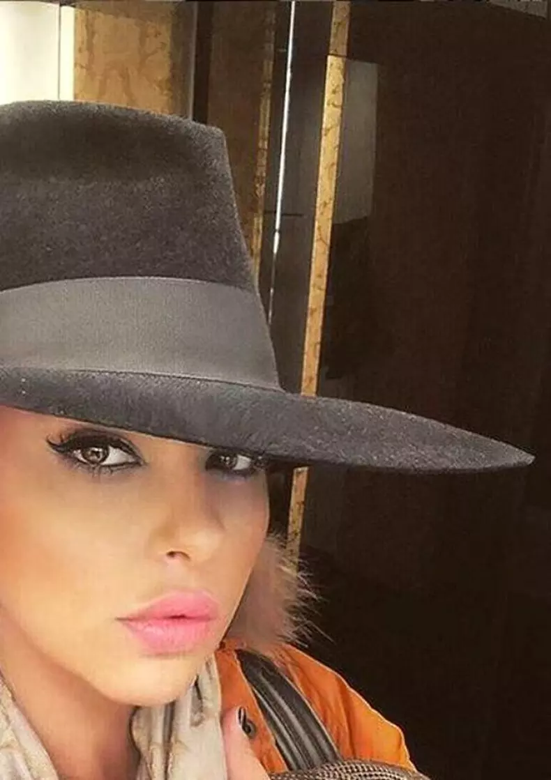 Lavinia Pârva susține că nu și-a făcut decât intervenții estetice minim invazive.