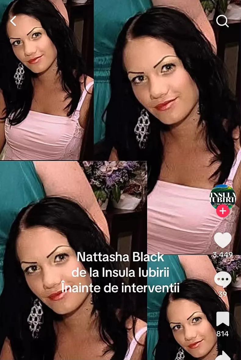 nattasha inainte de operatii4