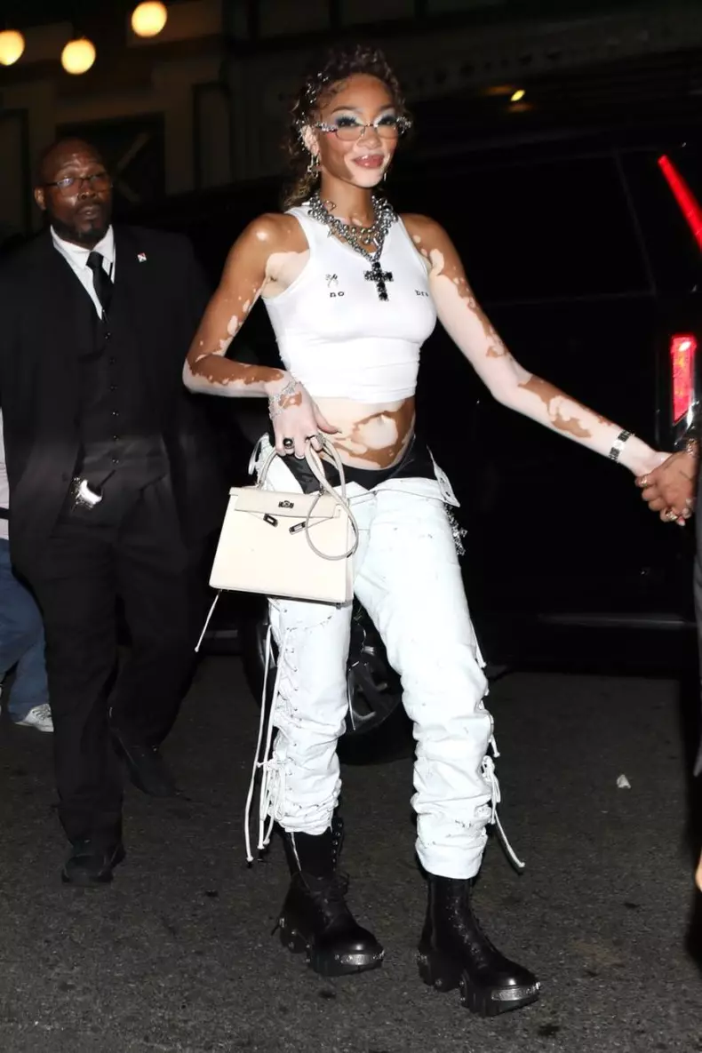 Winnie Harlow