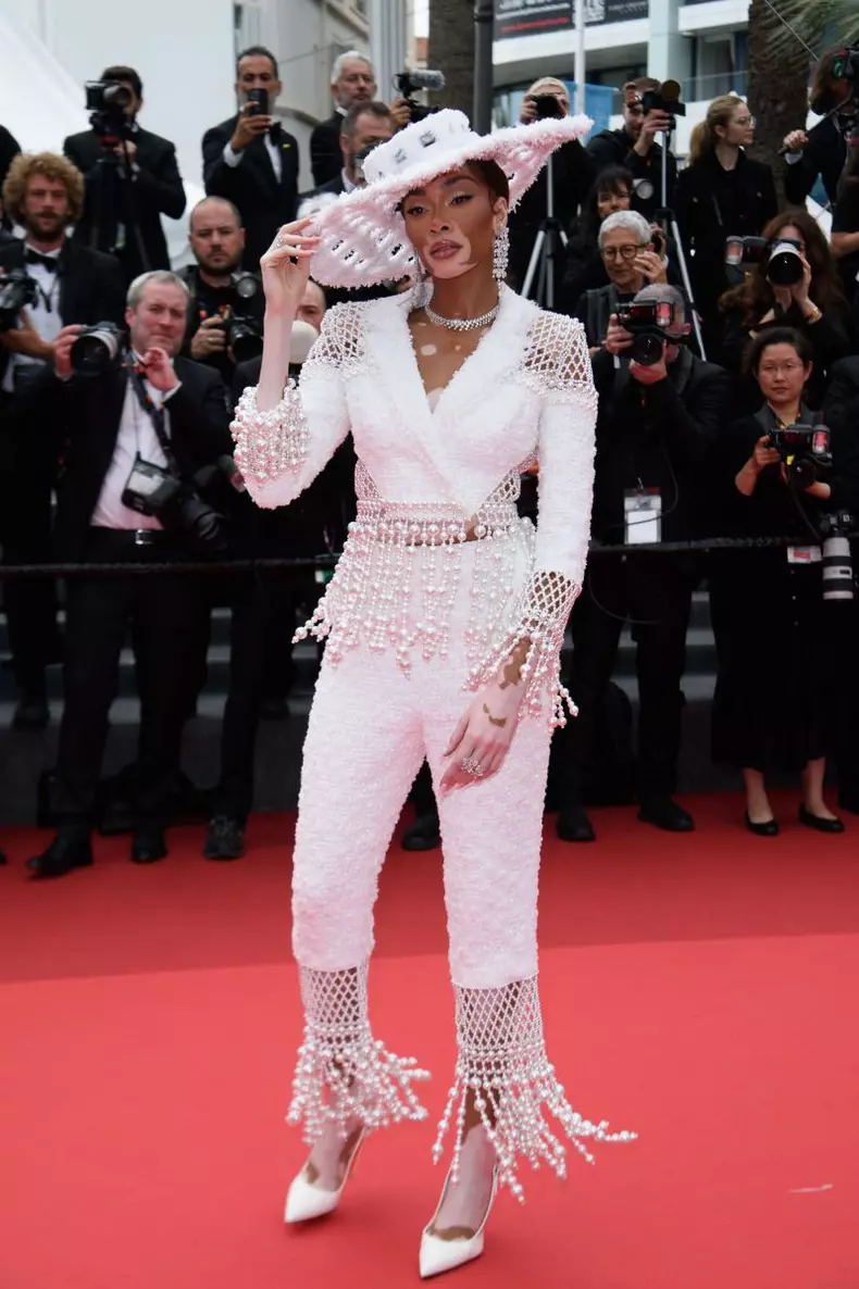 Winnie Harlow