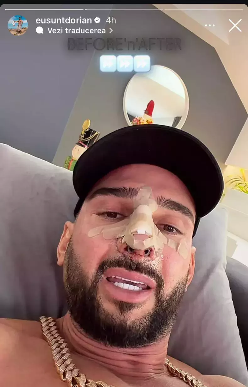 dorian-popa-s-a-operat-la-nas-2