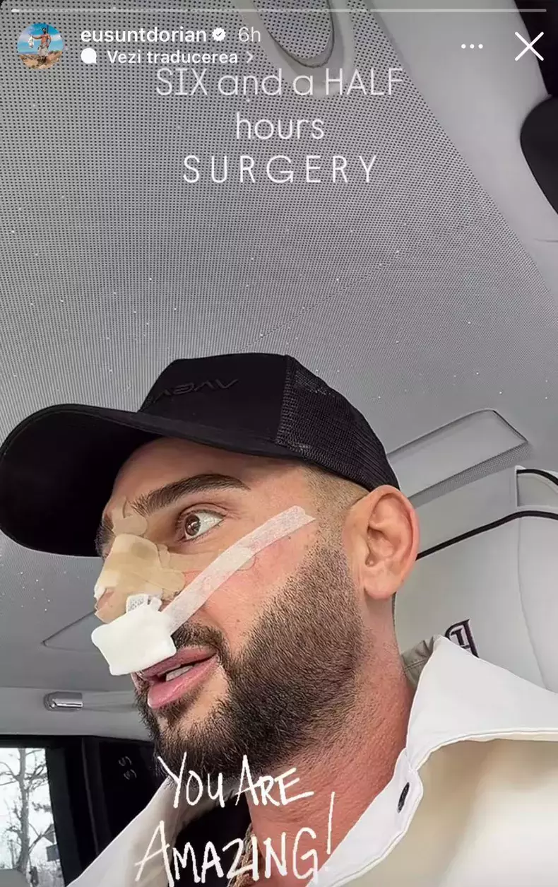 dorian-popa-s-a-operat-la-nas-1