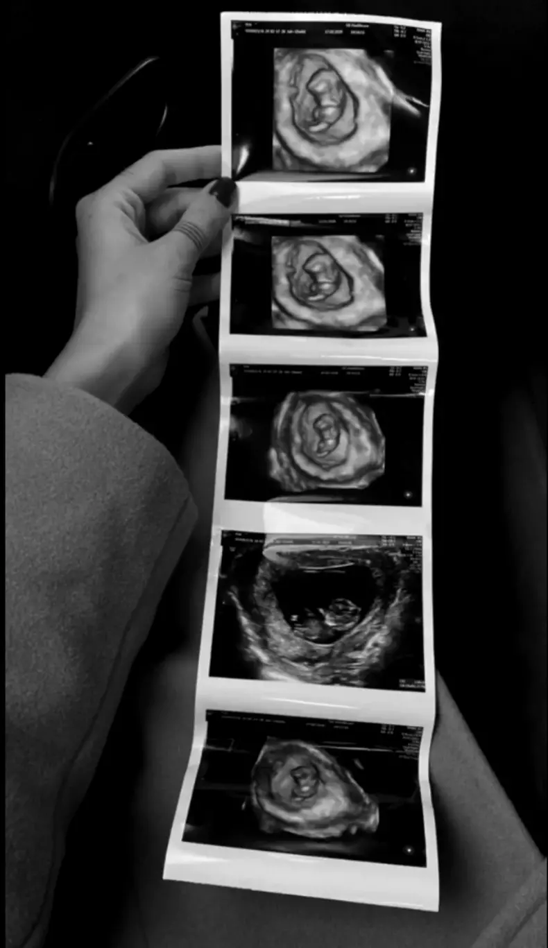 Alina-Ceușan-însărcinată-1