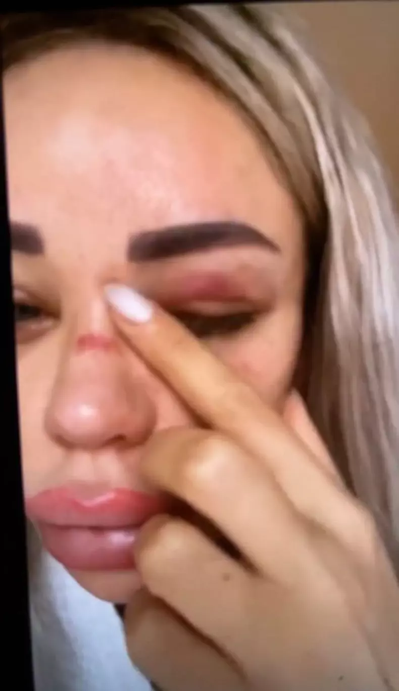 Bianca Drăgușanu, bătută (1)