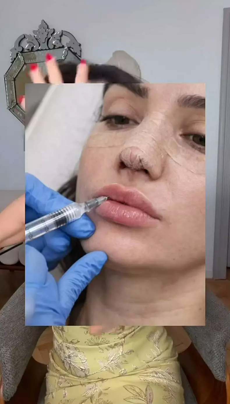 Ana Morodan 4