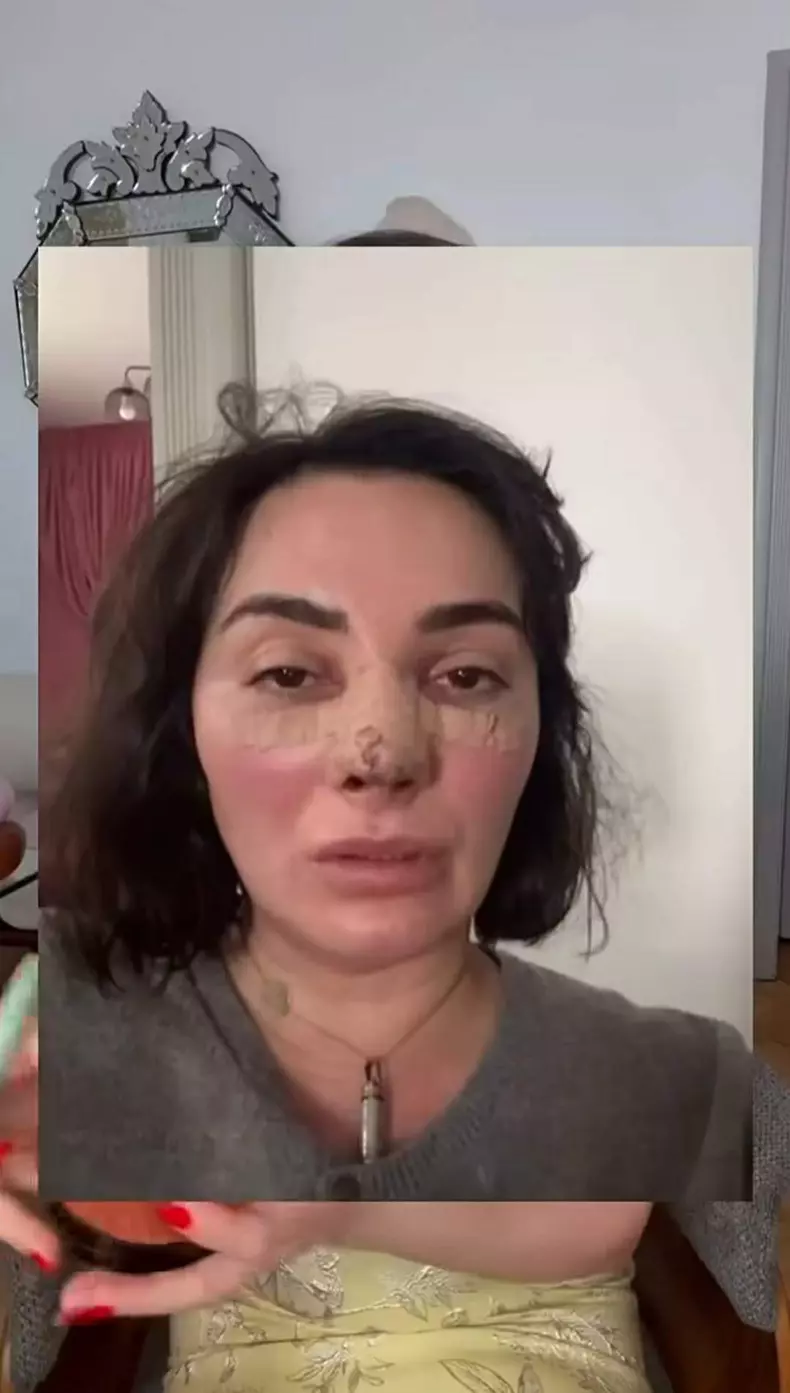 Ana Morodan