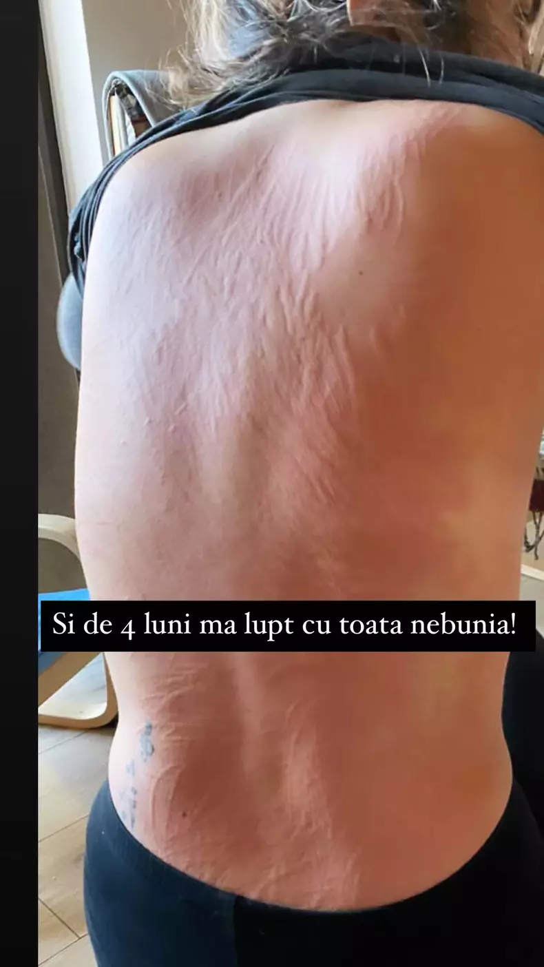 Erupția artistei