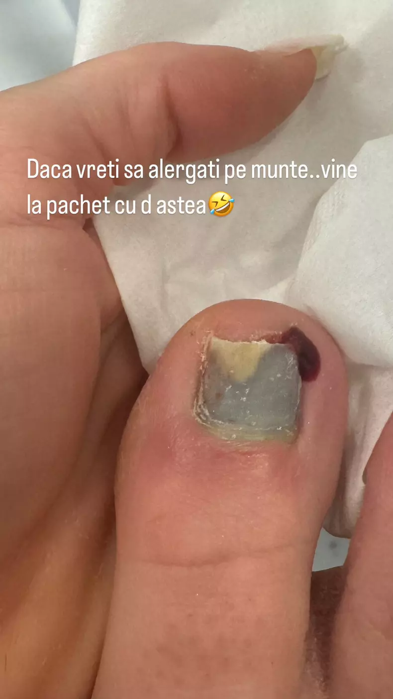 delia accidentare