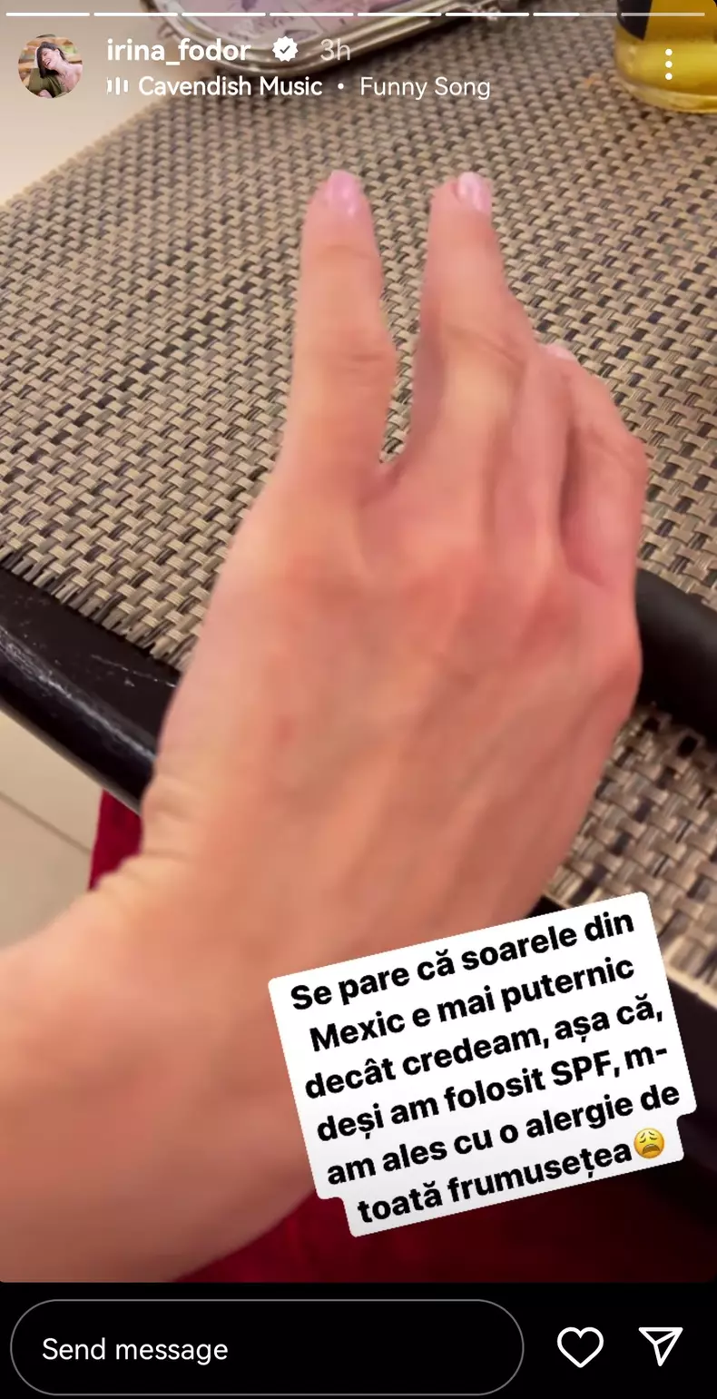 America-Express-2022.-De-ce-a-ajuns-Irina-Fodor-pe-mana-medicilor-din-Mexic.-Noi-imagini-de-la-filmari-5