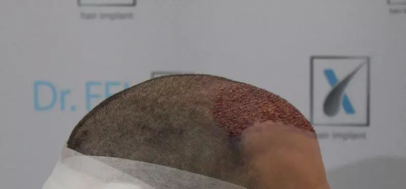 Auto-bild_1754029798-HiOD