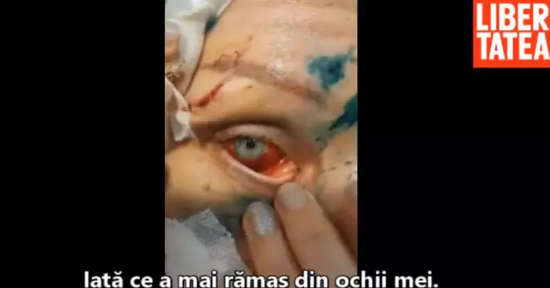 femeie-insangerata-3-1