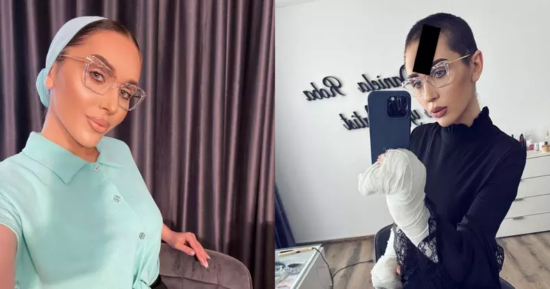 dana-roba-acuzata-ca-cerseste-dupa-ce-a-cerut-bani-pentru-operatiile-de-care-are-nevoie-make-up-artista-vrea-sa-si-faca-operatie-de-reconstructie-a-mainilor
