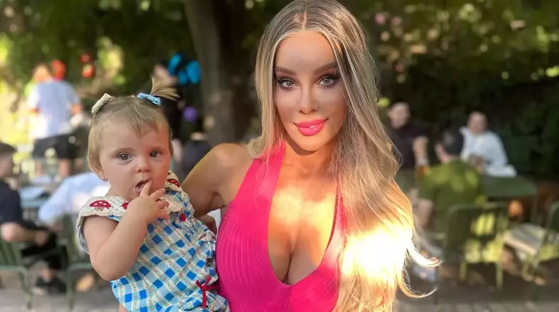 alina-laufer-de-nerecunoscut-dupa-liftingul-facial