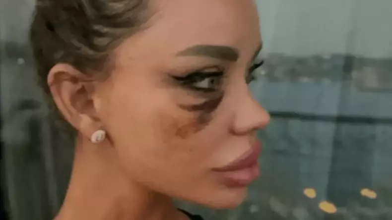 bianca